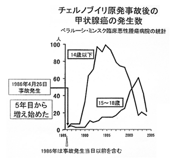 甲状腺がんの発生数の統計グラフ